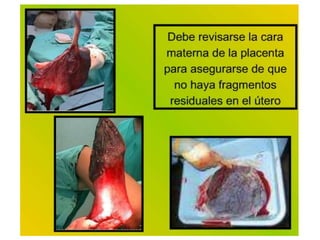 Asistencia del parto