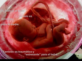 Sí, porque el parto  no solo es doloroso  para la madre.   También es traumático y  “estresante” para el bebé. 