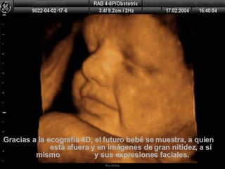 Gracias a la ecografía 4D, el futuro bebé se muestra, a quien  está afuera y en imágenes de gran nitidez, a sí mismo  y sus expresiones faciales. 
