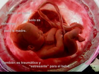 Sí, porque el partoSí, porque el parto
no solo esno solo es
dolorosodoloroso
para la madre.para la madre.
También es traumático yTambién es traumático y
“estresante” para el bebé.“estresante” para el bebé.
 