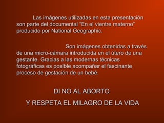 Las imágenes utilizadas en esta presentaciónLas imágenes utilizadas en esta presentación
son parte del documental “En el vientre materno”son parte del documental “En el vientre materno”
producido por National Geographic.producido por National Geographic.
Son imágenes obtenidas a travésSon imágenes obtenidas a través
de una micro-cámara introducida en el útero de unade una micro-cámara introducida en el útero de una
gestante. Gracias a las modernas técnicasgestante. Gracias a las modernas técnicas
fotográficas es posíble acompañar el fascinantefotográficas es posíble acompañar el fascinante
proceso de gestación de un bebéproceso de gestación de un bebé..
DI NO AL ABORTODI NO AL ABORTO
Y RESPETA EL MILAGRO DE LA VIDAY RESPETA EL MILAGRO DE LA VIDA
 