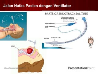 Jalan Nafas Pasien dengan Ventilator
Infeksi Nosokomial/ Sisilia I.W
 