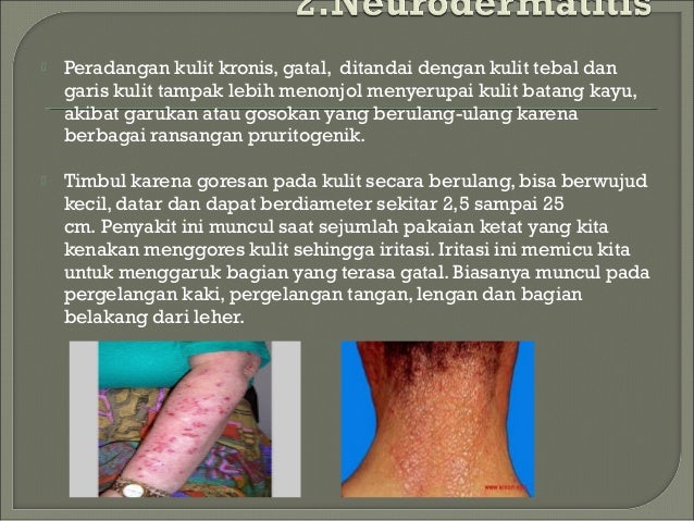 Askep dermatitis