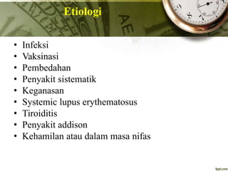 Etiologi
• Infeksi
• Vaksinasi
• Pembedahan
• Penyakit sistematik
• Keganasan
• Systemic lupus erythematosus
• Tiroiditis
• Penyakit addison
• Kehamilan atau dalam masa nifas
 