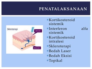 Kortikosteroid
sistemik
Interferon alfa
sistemik
Kortikosteroid
intralesi
Skleroterapi
Bedah Laser
Bedah Eksisi
Topikal
PENATALAKSANAAN
 