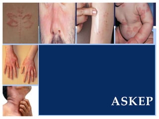 ASKEP
 