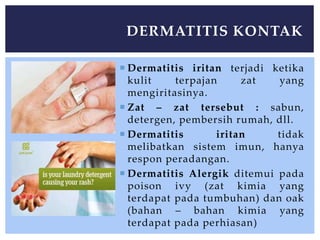  Dermatitis iritan terjadi ketika
kulit terpajan zat yang
mengiritasinya.
 Zat – zat tersebut : sabun,
detergen, pembersih rumah, dll.
 Dermatitis iritan tidak
melibatkan sistem imun, hanya
respon peradangan.
 Dermatitis Alergik ditemui pada
poison ivy (zat kimia yang
terdapat pada tumbuhan) dan oak
(bahan – bahan kimia yang
terdapat pada perhiasan)
DERMATITIS KONTAK
 