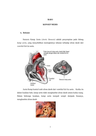 BAB I
KONSEP MEDIS

A. Defenisi

Stenosis Katup Aorta (Aortic Stenosis) adalah penyempitan pada lubang
katup aorta, yang menyebabkan meningkatnya tahanan terhadap aliran darah dari
ventrikel kiri ke aorta.

Aorta Katup kontrol arah aliran darah dari ventrikel kiri ke aorta . Ketika itu
dalam keadaan baik, katup aorta tidak menghambat aliran darah antara kedua ruang.
Dalam beberapa keadaan, katup aorta menjadi sempit daripada biasanya,
menghambat aliran darah.

1

 