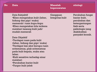 No

Data

Masalah
keperawatan

Data Subjektif
Gangguan
•Klien mengatakan kulit (leher, Integritas kulit
hidung dan pipi/ muka)
memerah/ ruam kupu-kupu
•Klien mengatakan bila terkena
matahari lansung kulit jadi/
mudah memerah
 
Data Objektif
•Terdapat ruam pada kulit
(leher, hidung dan pipi/ muka)
•Terdapat lesi akut berupa ruam
eritematous, plak eritematous
pada kulit kepala, muka atau
leher.
•Kulit sensitive terhadap sinar
matahari
•Perubahan barier kulit
•Turgor kulit jelek

etiologi

Perubahan fungsi
barier kulit,
perubahan dan
ketergantungan
fisik serta
psikologis yang
diakibatkan
penyakit kronik.

 