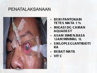 PENATALAKSANAAN BERI PANTOKAIN TETES MATA 1 % IRIGASI DG CAIRAN AQUADEST ASAM 30MEN,BASA 1JAM MINIMAL 1L SIKLOPLEGI,ANTIBIOTIKA BEBAT MATA VIT C by.  N. Syamsi,  S.Kep.Ns 
