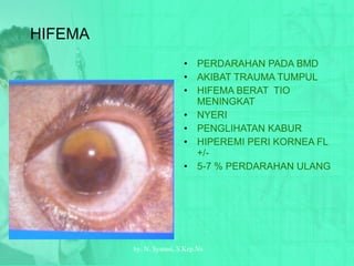 HIFEMA PERDARAHAN PADA BMD AKIBAT TRAUMA TUMPUL HIFEMA BERAT  TIO MENINGKAT NYERI PENGLIHATAN KABUR HIPEREMI PERI KORNEA FL +/- 5-7 % PERDARAHAN ULANG by.  N. Syamsi,  S.Kep.Ns 
