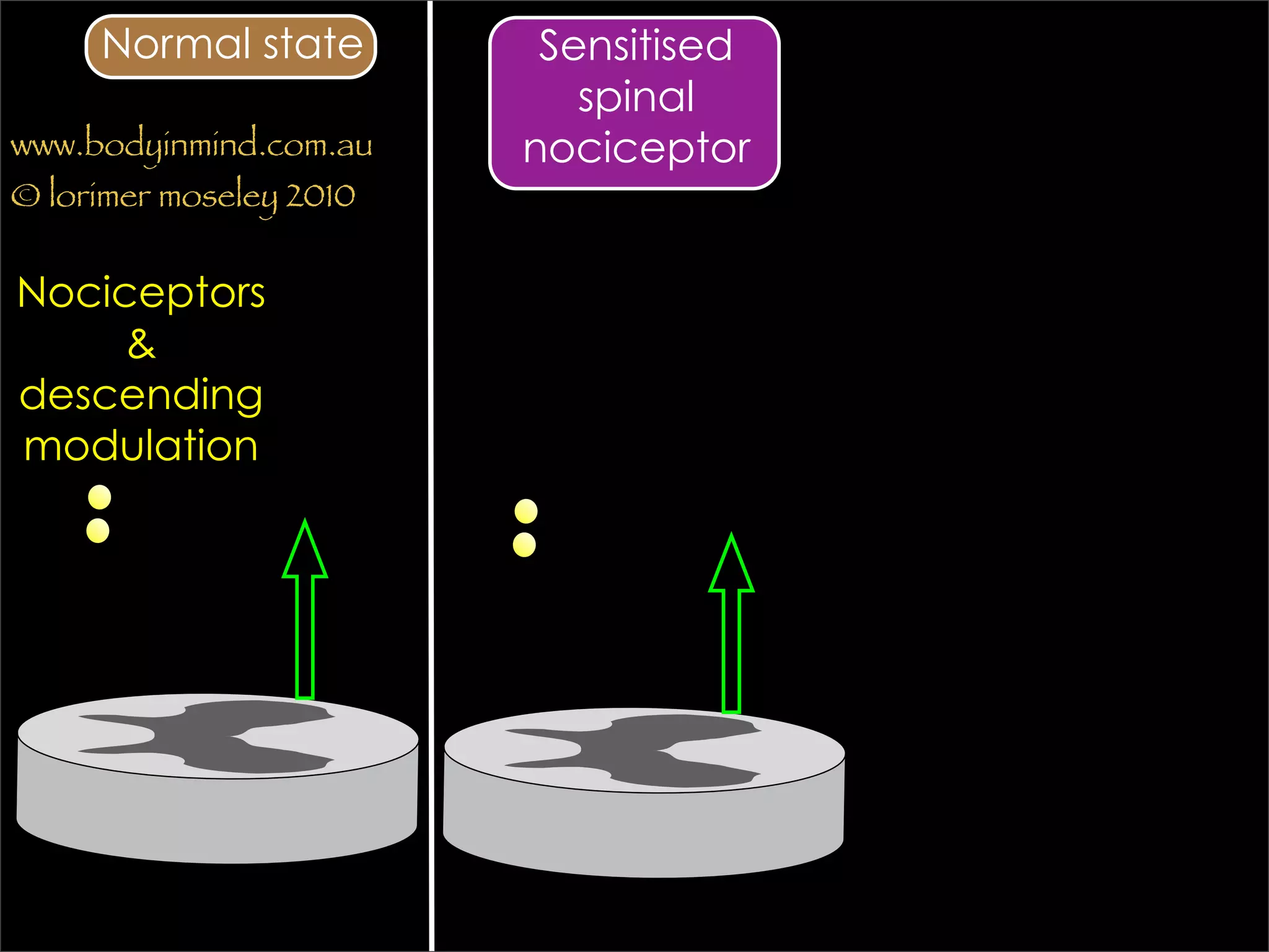 Normal state         Sensitised
                            spinal
www.bodyinmind.com.au    nociceptor
© lorimer moseley 2010


Nociceptors
     &
descending
modulation
 