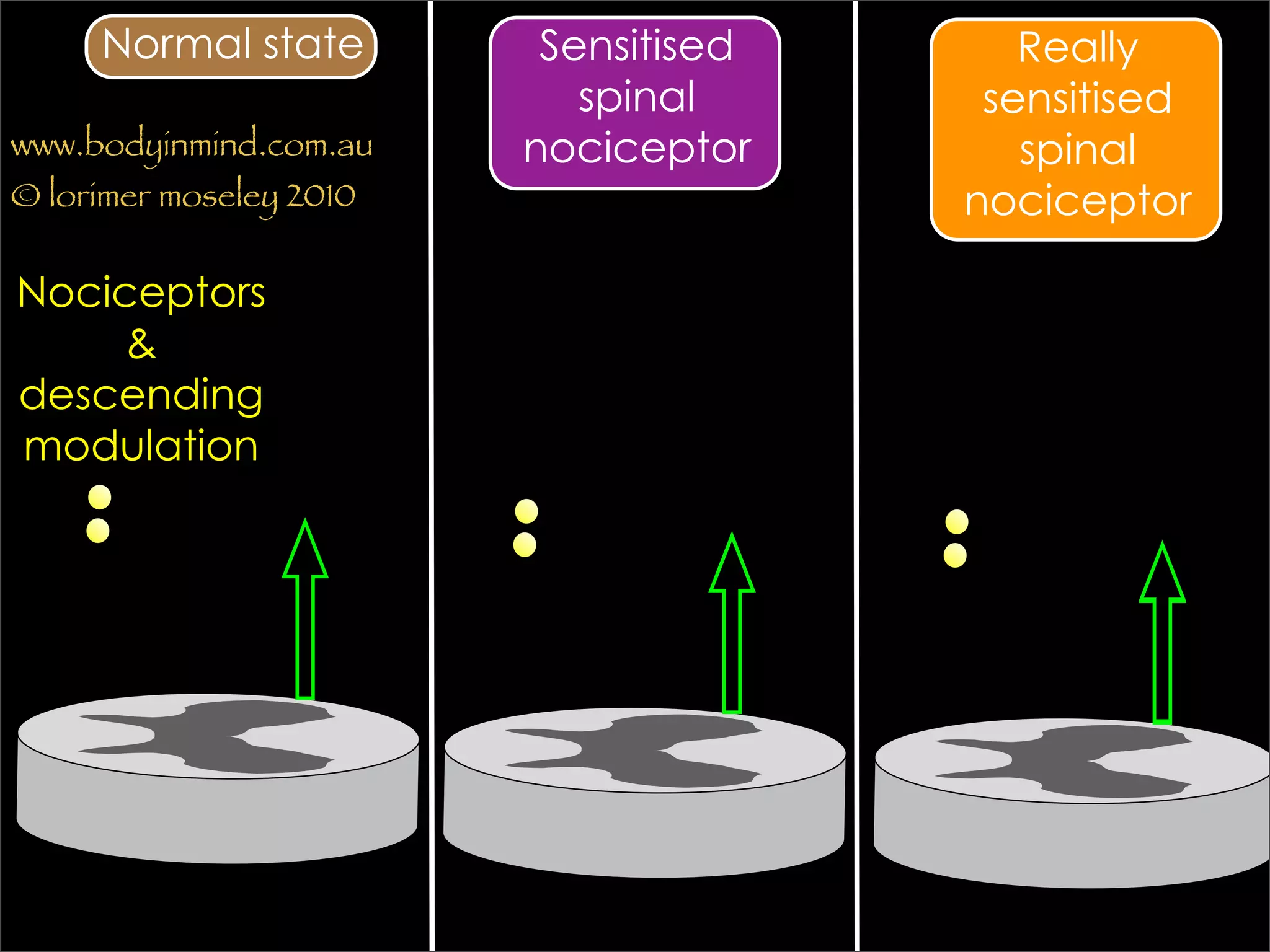 Normal state         Sensitised      Really
                            spinal      sensitised
www.bodyinmind.com.au    nociceptor       spinal
© lorimer moseley 2010                 nociceptor

Nociceptors
     &
descending
modulation
 