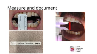 Measure and document
 