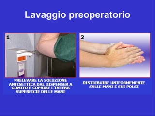 Lavaggio preoperatorio
 