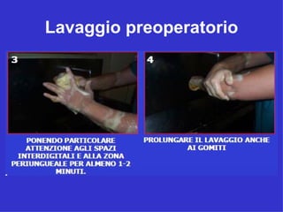 Lavaggio preoperatorio
 