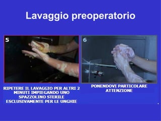 Lavaggio preoperatorio
 