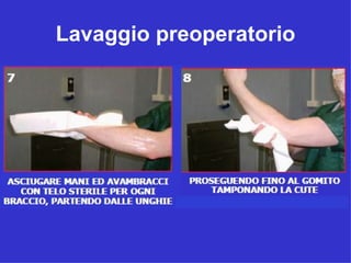 Lavaggio preoperatorio
 