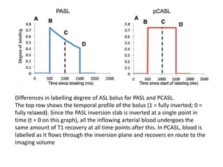 Differences in labelling degree of ASL bolus for PASL and PCASL.
The top row shows the temporal profile of the bolus (1 = fully inverted; 0 =
fully relaxed). Since the PASL inversion slab is inverted at a single point in
time (t = 0 on this graph), all the inflowing arterial blood undergoes the
same amount of T1 recovery at all time points after this. In PCASL, blood is
labelled as it flows through the inversion plane and recovers en route to the
imaging volume
 