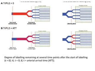 Degree of labelling remaining at several time points after the start of labelling
(t = 0): A, t = 0; B, t = arterial arrival time (ATT);
 