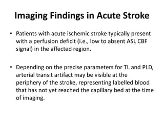 Imaging Findings in Acute Stroke
• Patients with acute ischemic stroke typically present
with a perfusion deficit (i.e., low to absent ASL CBF
signal) in the affected region.
• Depending on the precise parameters for TL and PLD,
arterial transit artifact may be visible at the
periphery of the stroke, representing labelled blood
that has not yet reached the capillary bed at the time
of imaging.
 