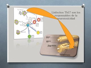 Linfocitos Th17 son los responsables de la neurotoxicidad 