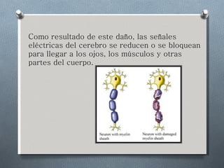Como resultado de este daño, las señales eléctricas del cerebro se reducen o se bloquean para llegar a los ojos, los músculos y otras partes del cuerpo.  