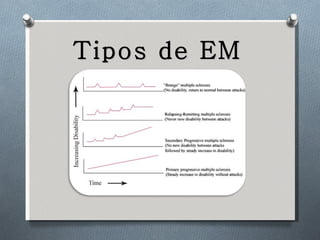 Tipos de EM 