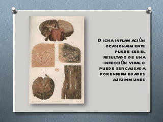 Dicha inflamación ocasionalmente puede ser el resultado de una infección viral o puede ser causada por enfermedades autoinmunes 