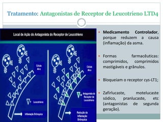 Tratamento: Antagonistas de Receptor de Leucotrieno LTD4
 Medicamento Controlador,
porque reduzem a causa
(inflamação) da asma.
 Formas farmacêuticas:
comprimidos, comprimidos
mastigáveis e grânulos.
 Bloqueiam o receptor cys-LT1;
 Zafirlucaste, motelucaste
sódico, pranlucaste, etc
(antagonistas de segunda
geração).
 