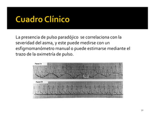 La presencia de pulso paradójico se correlaciona con la
severidad del asma, y este puede medirse con un
esfigmomanómetro manual o puede estimarse mediante el
trazo de la oximetría de pulso.




                                                          50
 