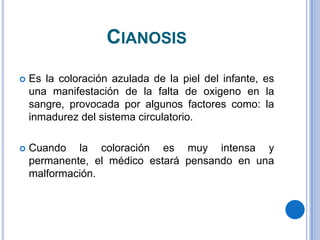 CIANOSIS
   Es la coloración azulada de la piel del infante, es
    una manifestación de la falta de oxigeno en la
    sangre, provocada por algunos factores como: la
    inmadurez del sistema circulatorio.

   Cuando la coloración es muy intensa y
    permanente, el médico estará pensando en una
    malformación.
 