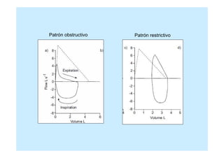 Patrón obstructivo   Patrón restrictivo
 