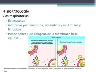 •FISIOPATOLOGÍA
Vías respiratorias:
   ▫ Edematosas
   ▫ infiltradas por leucocitos, eosinófilos y neutrófilos y
     linfocitos
   ▫ Puede haber ↑ de colágena de la membrana basal
     epitelial.




 Medicina Interna Harrison 16 Edicion, Parte IX. Enfermedades del aparato respiratorio, Sección 2. Enfermedades del aparato respiratorio, Capítulo 236.
 Asma
 