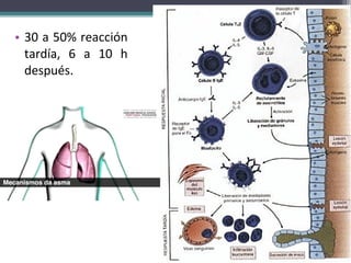 • 30 a 50% reacción
  tardía, 6 a 10 h
  después.
 