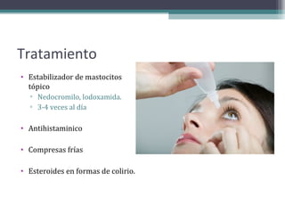 Tratamiento
• Estabilizador de mastocitos
  tópico
   ▫ Nedocromilo, lodoxamida.
   ▫ 3-4 veces al día

• Antihistaminico

• Compresas frías

• Esteroides en formas de colirio.
 