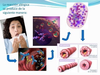 La reacción alérgica
se produce de la
siguiente manera:
 
