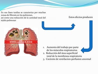 En sus fases tardías se caracteriza por muchas
zonas de fibrosis en los pulmones,
así como una reducción de la cantidad total del
tejido pulmonar
Estos efectos producen
1. Aumento del trabajo por parte
de los músculos respiratorios
2. Reducción del área superficial
total de la membrana respiratoria
3. Cociente de ventilacion-perfusion anormal
 