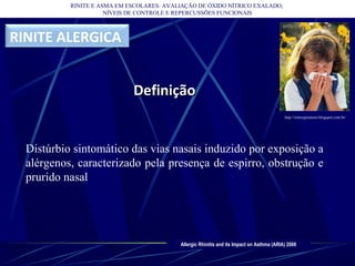 Distúrbio sintomático das vias nasais induzido por exposição a
alérgenos, caracterizado pela presença de espirro, obstrução e
prurido nasal
RINITE E ASMA EM ESCOLARES: AVALIAÇÃO DE ÓXIDO NÍTRICO EXALADO,
NÍVEIS DE CONTROLE E REPERCUSSÕES FUNCIONAIS
Allergic Rhinitis and its Impact on Asthma (ARIA) 2008
DefiniçãoDefinição
RINITE ALERGICA
http://sistrespiratorio.blogspot.com.br/
 