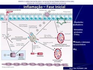 RINITE E ASMA EM ESCOLARES: AVALIAÇÃO DE ÓXIDO NÍTRICO EXALADO,
NÍVEIS DE CONTROLE E REPERCUSSÕES FUNCIONAIS
Inflamação – Fase InicialInflamação – Fase Inicial
GALLI, TSAI, PILIPONSKY, 2008
- Mastócito:
mediadores
- histamina
- proteases
- TNFα
Sinais e sintomas
caracteristicos
IL
NO
 