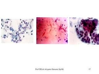 Prof DR.dr.Ariyanto Harsono SpAK

17

 