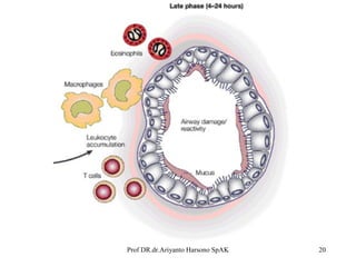 Prof DR.dr.Ariyanto Harsono SpAK

20

 