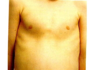 Prof DR.dr.Ariyanto Harsono SpAK

3

 