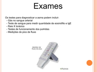 Exames
Os testes para diagnosticar a asma podem incluir:
- Gás no sangue arterial
- Teste de sangue para medir quantidade de eosinófilo e IgE
- Raio X torácico
- Testes de funcionamento dos pulmões
- Medições de pico de fluxo
 