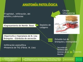 4/30Martes, 26 de Mayo 2014
UNIVERSIDAD TÉCNICA DE MACHALA
FACULTAD DE CIENCIAS QUÍMICAS Y DE LA SALUD
ESCUELA DE CIENCIAS MÉDICAS
CUARTO AÑO “A”
BIBLIOGRAFÍA:C.Picado Valles, A. Agustí Garcia – Navarro, R. Rodriguez – Roisin, J. de Gracia
Roldán.”ENFERMEDADES DE LAS VIAS (AÉREASASMA BRONQUIAL)”. En: Farreras Valentí, C. Rozman.
MEDICINA INTERNA. Décimoséptima Edición. Barcelona España: Elsevier 2012. Pág 651 - 660
ANATOMÍA PATOLÓGICA
11/26Martes, 26 de Mayo 2014
•Fragilidad , infiltración, del
epitelio y submucosa
Células
inflamatorias
•Engrosamiento de Membr. Basal
•Hipertrofia e hiperplasia de M. Lisa
Bronquios – Glándulas de secreción Oclusión luz de
bronquios y bronquiolos
•Infiltración eosinofílica
•Presencia de Th2 (Fibras M. Liso)
Depósito de
colágeno
Secundarias
REPARACIÓN
lesiones de la
Mucosa
R//
INFLAMATORIA
 