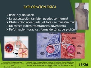 Roncus y sibilancia
La auscultación también puedes ser normal
Obstrucción acentuada ,el tórax se muestra mudo
No ofrece ruidos respiratorios adventicios
Deformación torácica ,forma de tórax de pichón
Universidad técnica de Machala
Facultad de ciencias químicas y de la
salud
Escuela de ciencias medicas
A. Picado Valles , A. Agustí García –Navarro , R. Rodríguez –Roisin , J.De Gracia
Roldan. “ENFERMEDADES DE LAS VIAS AEREAS" (Asma bronquial). En: FARRERAS -
ROZMAN. MEDICINA INTERNA. XVII edición. España: ELSEVIER España , SL, 654,
660 p.
15/26
 