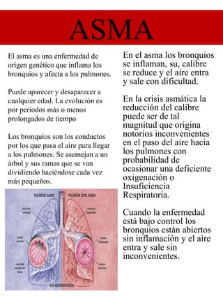 ASMA
El asma es una enfermedad de
origen genético que inflama los
bronquios y afecta a los pulmones.
Puede aparecer y desaparecer a
cualquier edad. La evolución es
por periodos más o menos
prolongados de tiempo
Los bronquios son los conductos
por los que pasa el aire para llegar
a los pulmones. Se asemejan a un
árbol y sus ramas que se van
dividiendo haciéndose cada vez
más pequeños.
En el asma los bronquios
se inflaman, su, calibre
se reduce y el aire entra
y sale con dificultad.
En la crisis asmática la
reducción del calibre
puede ser de tal
magnitud que origina
notorios inconvenientes
en el paso del aire hacia
los pulmones con
probabilidad de
ocasionar una deficiente
oxigenación o
Insuficiencia
Respiratoria.
Cuando la enfermedad
está bajo control los
bronquios están abiertos
sin inflamación y el aire
entra y sale sin
inconvenientes.
 