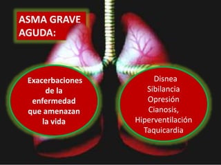 ASMA GRAVE
AGUDA:
Exacerbaciones
de la
enfermedad
que amenazan
la vida
Disnea
Sibilancia
Opresión
Cianosis,
Hiperventilación
Taquicardia
 