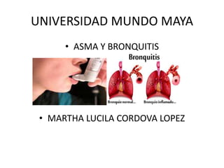 UNIVERSIDAD MUNDO MAYA
• ASMA Y BRONQUITIS
• MARTHA LUCILA CORDOVA LOPEZ
 