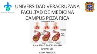 UNIVERSIDAD VERACRUZANA
FACULTAD DE MEDICINA
CAMPUS POZA RICA
JUAN PABLO GARCES AMARO
GRUPO: 501
ASMA ALERGICA
 